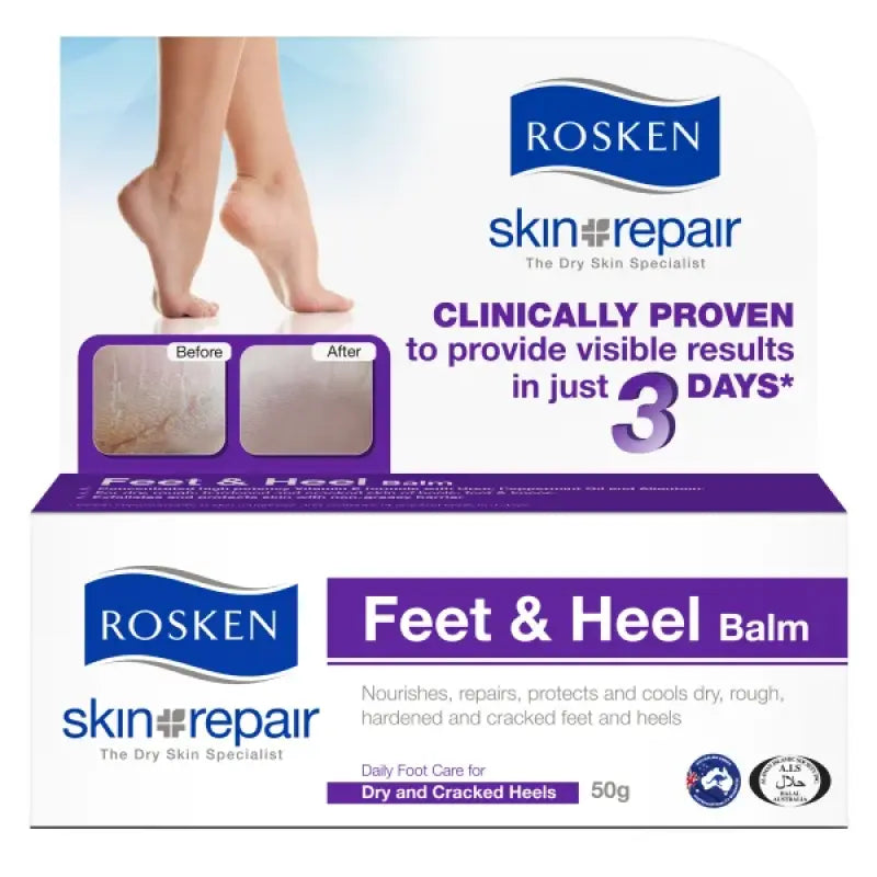 Rosken Feet And Heel Balm 50g – Michael's Chemist