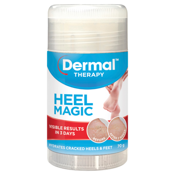 Dermal Therapy Heel Magic 70g